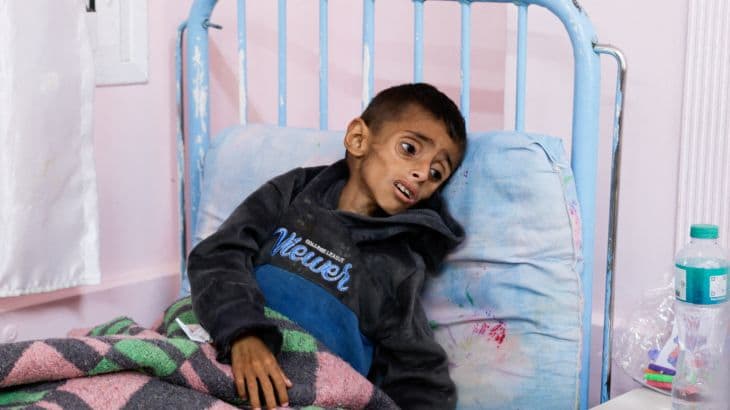 Žudymai Gazos Ruože tęsiasi: per vieną dieną žuvo mažiausiai 31 palestinietis, vaikai miršta iš bado – LT lyderiai tyli