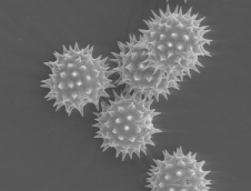 Elektroniniu mikroskopu padidinta žiedadulkė. Žiedadulkės yra labai dažnai pasitaikantys alergenai.